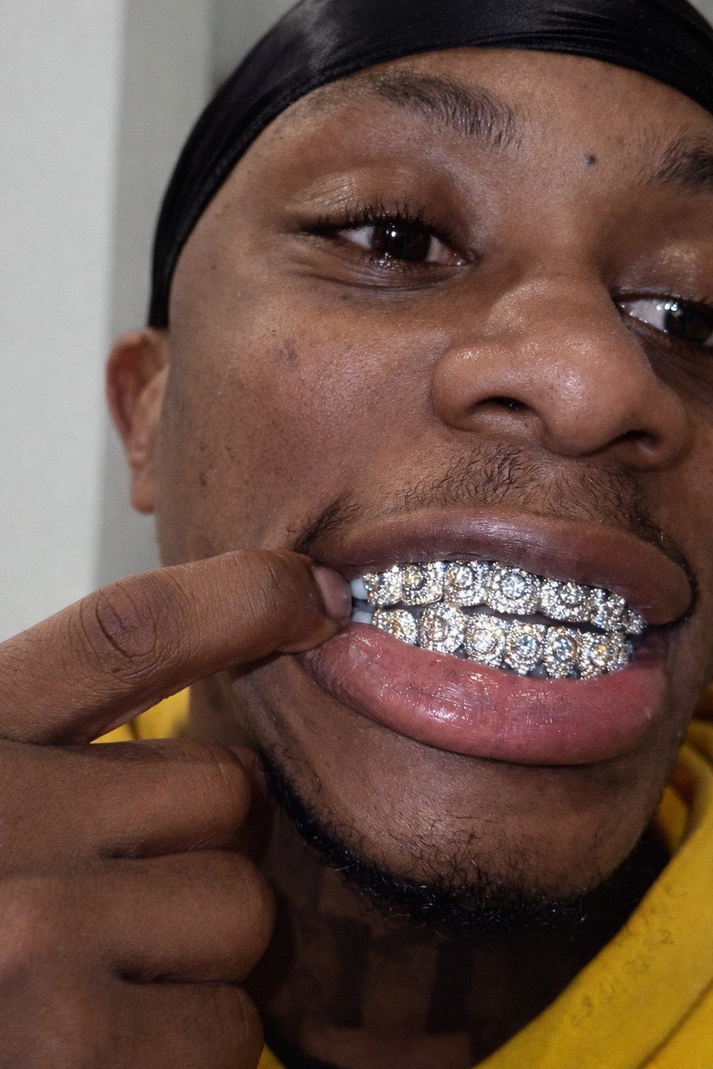 YZ Jewelers client wearing a custom fully iced grillz set