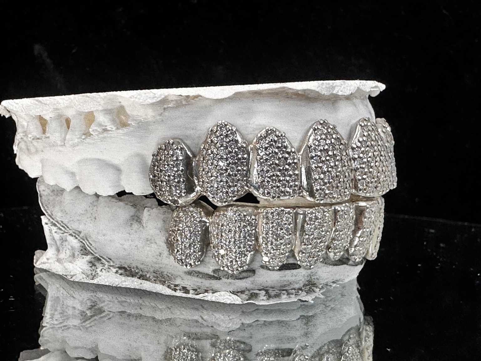 Left angle view of fully iced top and bottom grillz