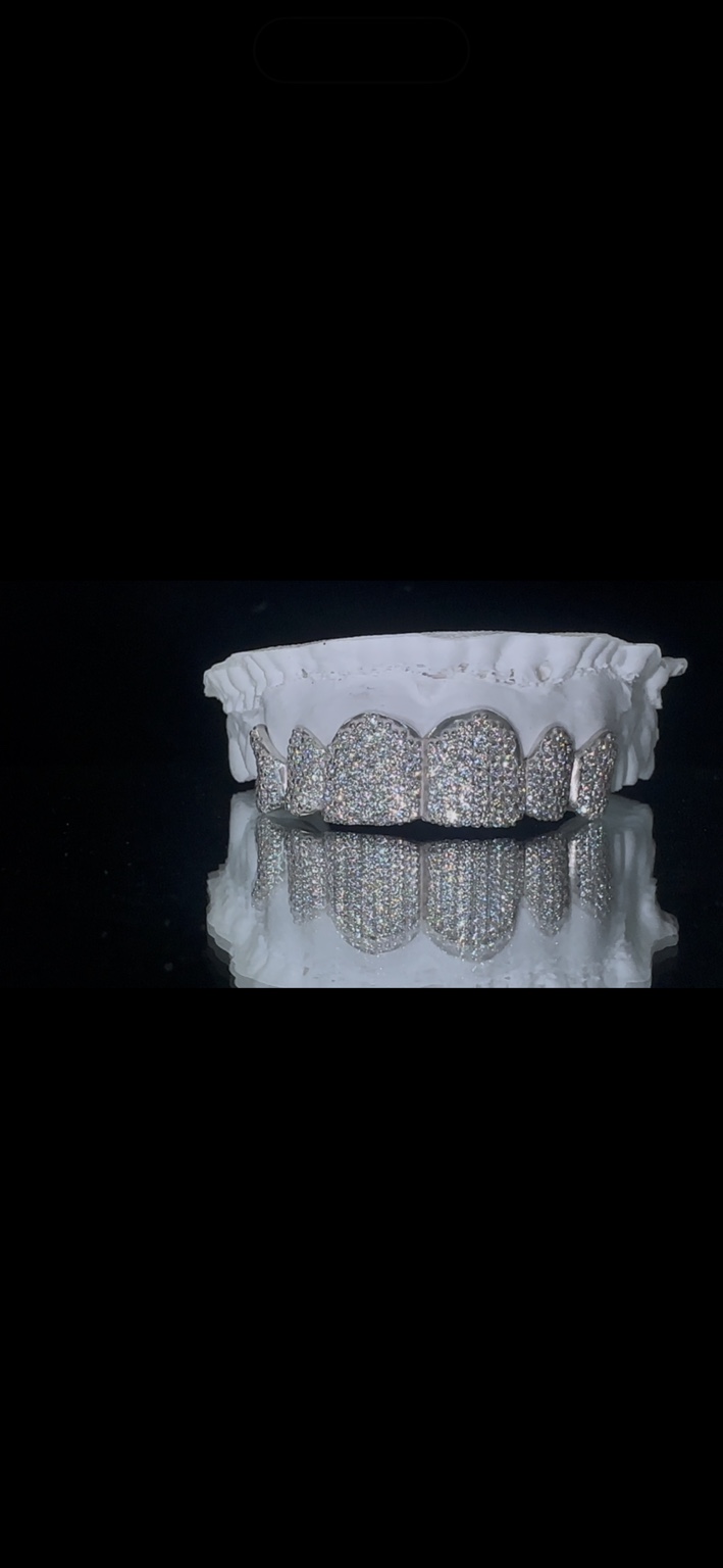 Fully iced grillz displayed on a dental model