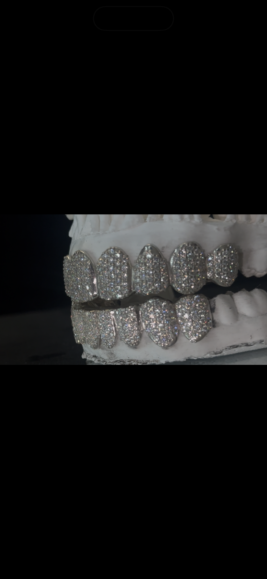 Fully iced custom top and bottom grillz made by YZ Jewelers