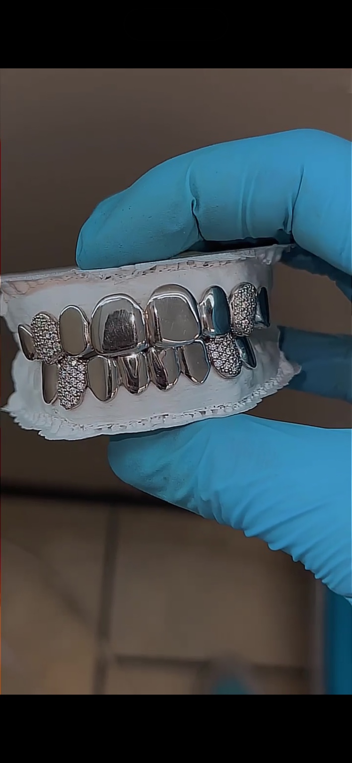 Polished silver and iced mixed-finish grillz made by YZ Jewelers